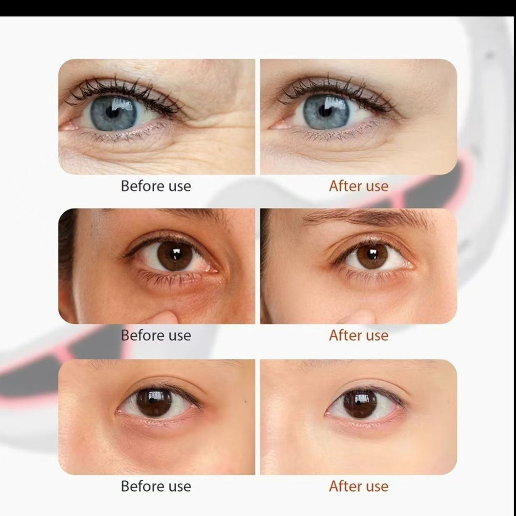 EMS Microcurrent Eye Massager and Essence Device
